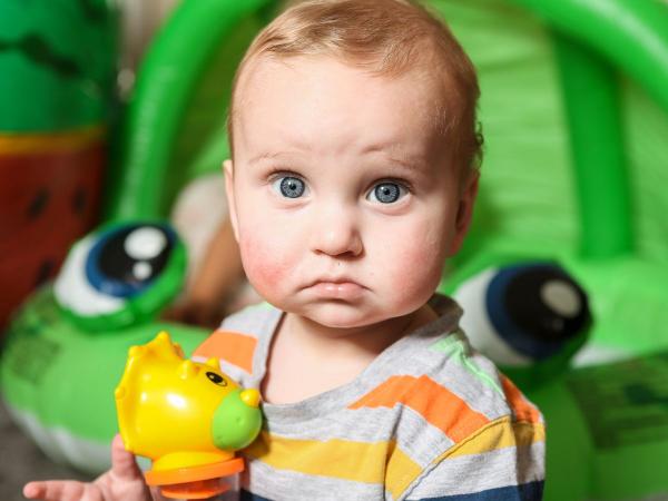 طفل يُعاني من 50 نوعاً من الحساسية