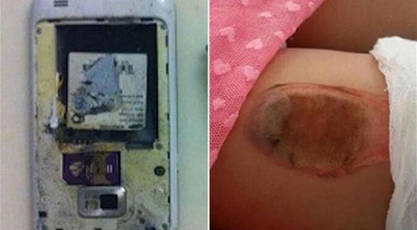 بالصور: انفجار هاتف سامسونغ أس 2 بجيب فتاة صغيرة