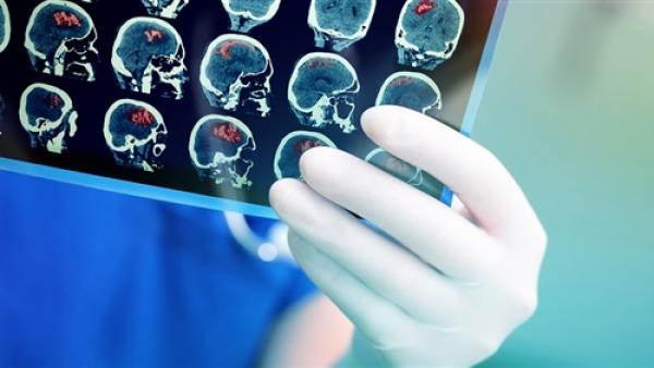 علماء ينجحون في حفظ أدمغة بعد الموت