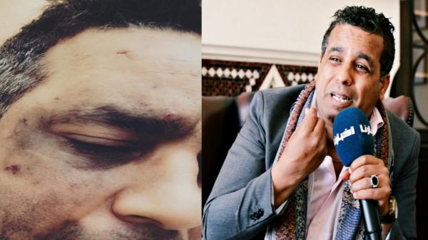 بسبب حواره مع "أخبارنا" حول المقاطعة .. الكوميدي "فتاح" يتعرض لاعتداء شنيع من طرف مجهولين (فيديو)