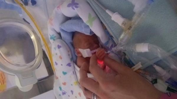 ولادة أصغر توأم بحجم كف اليد ببريطانيا