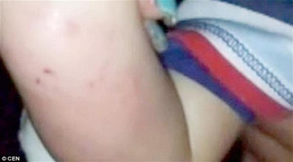 كولومبي يعض طفله الرضيع ليحميه من المثلية الجنسية