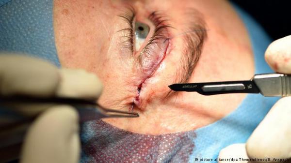 علاج جيني لنوع نادر من العمى!