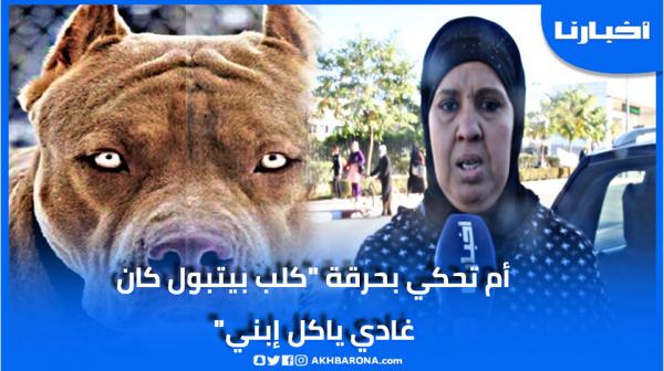 خطير.. كلب بيتبول ينهش لحم طفل صغير بوجدة والأم تحكي بحرقة الواقعة