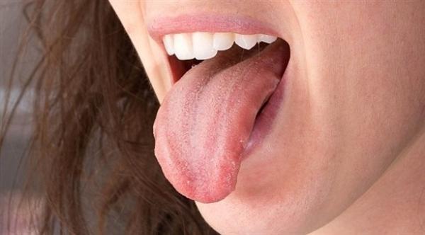 كيف تعرف حالتك الصحية من لسانك؟