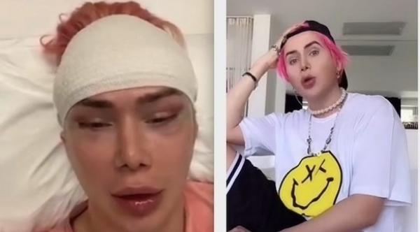 صانعة محتوى بريطانية تجري 18 جراحة تجميلية لتصبح شبيهة بالكوريين