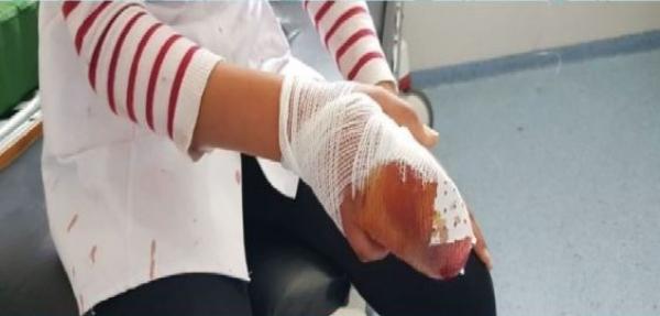 خطير..تلميذة تبتر أصبع زميلتها بالسلاح الأبيض في سيدي بنور