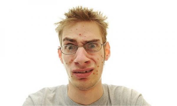 كيف تتخلص من حب الشباب باستخدام عصير الليمون