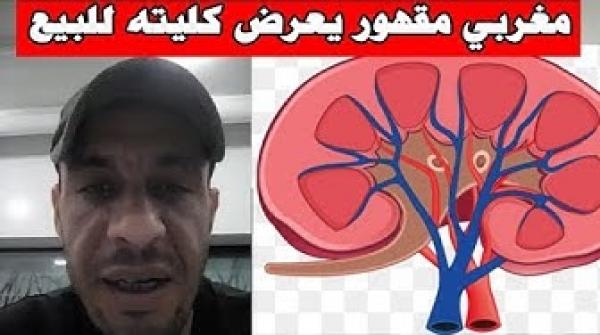 شاهد ..شاب مغربي يعرض كليته للبيع بسبب "ظروف قاهرة"