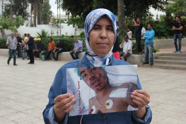 بالفيديو:أم الطفل الذي دهسته سيارة للقوات المساعدة في جرادة ..ابني مصاب بالشلل ولاعلاقة له بالحراك