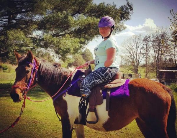 بالرغم من بتر ذراعها و ساقيها من أسفل.... تمارس رياضة ركوب الخيل