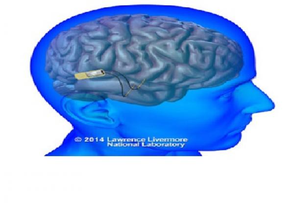 ابتكار شريحة إلكترونية تعيد الذاكرة