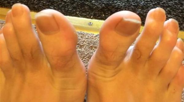 موقع إي باي يشتعل بعرض بستاني بريطاني أظافر قدميه للبيع