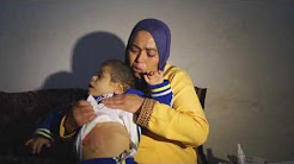 أم تطلب مساعدة لعملية طفلها المعاق