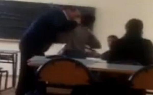 تلميذ يفقد عينه بمدرسة خاصة بالبيضاء بسبب أستاذه