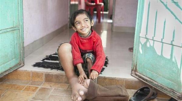  حير طفل، يبلغ من العمر 4 سنوات، مئات الأطباء في الهند 