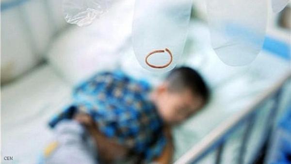 شريط مطّاطي ينمو داخل جلد طفل لسنوات