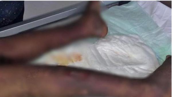 أخيرا...الوكيل العام يأمر بسجن المشغلة التي عذبت خادمتها حرقا بالدار البيضاء