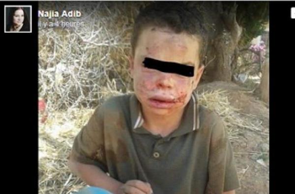 منتهى القسوة...أب اعتدى على ابنه بطريقة بشعة وحاول حرقه داخل فرن