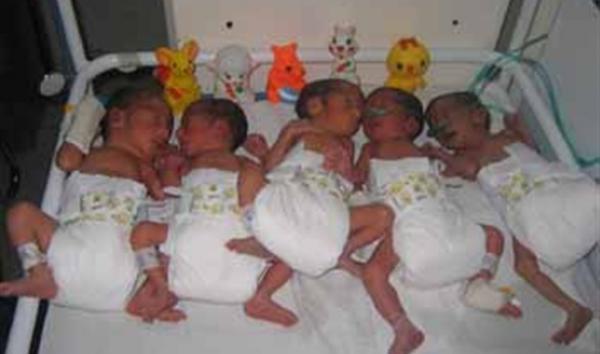 سبحان الرازق بغير حساب ، بشرى سارة لأبوي التوائم الخمسة بالمحمدية