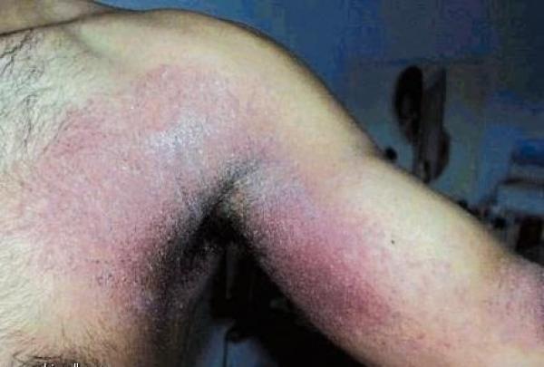 5 سموم قاتلة في مزيلات العرق!