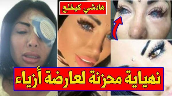 نهاية حزينة لعارضة أزياء حاولت تغيير لون عينيها