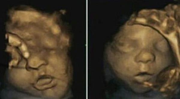 بالصور: الجنين يتمرن على الابتسام استعداداً للقاء والديه