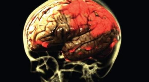 "طفيل" قاتل في حمامات السباحة يأكل المخ