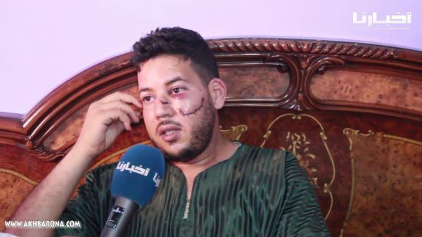 4 مقرقبين كانوا غادين قتلوني أنا وخويا..شاب يحكي لـ"أخبارنا" تفاصيل نجاته من اعتداء خطير (+18)