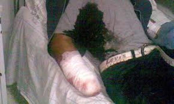 فاس: شاب يتعرض لهجوم أدى إلى قطع يده