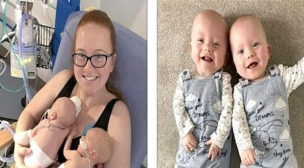 امرأة تنجب توأماً بفارق يومين