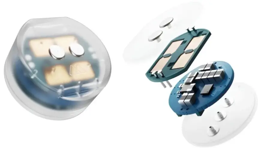 زرعة دماغية بحجم حبة توت تدخل أول اختبار لعلاج الاكتئاب المقاوم