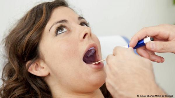 شعيرات سوداء تظهر فجأة في لسان امرأة.. وهذا هو السبب