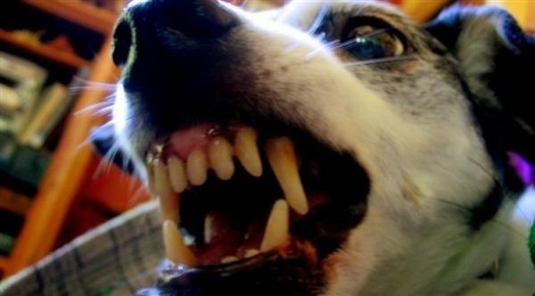 طبيبة تعالج سلوك طفل عدواني بلعاب كلب مسعور