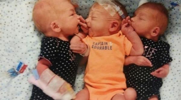 اعتقدت أنها تعاني من حصى في الكلية فتبين أنها حامل بثلاثة توائم