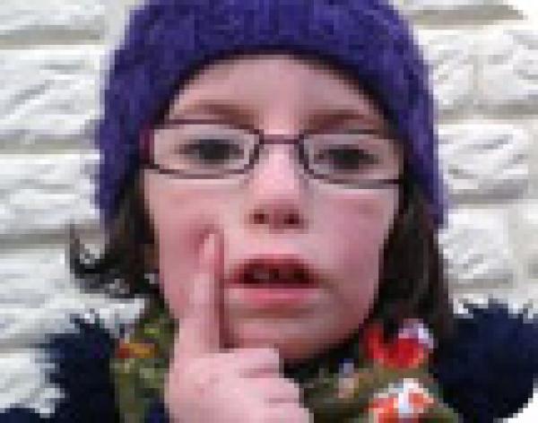 حالة نادرة : طفلة بريطانية غير قادرة على الابتسام