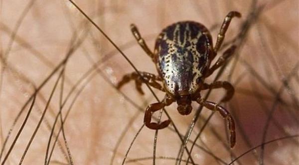 لدغة واحدة من هذه الحشرة أفقدتها أطرافها