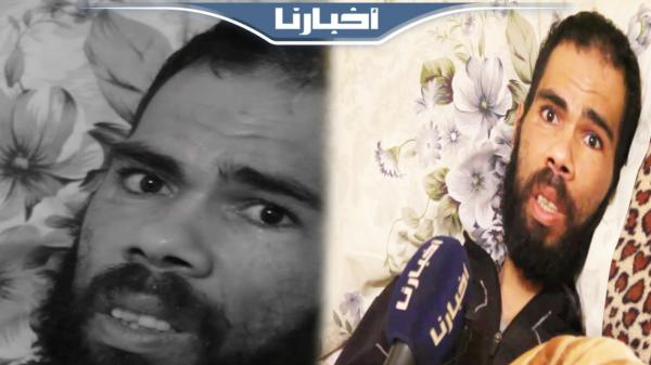 نداء مؤثر من شاب يعاني من تعفن لحمه بعد تعرضه لحادثة سير