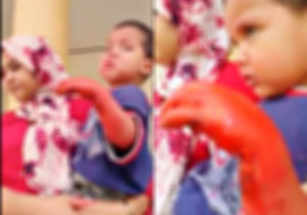 فيديو صادم: أم طفل صغير يده "خامجة" تصرخ مستغيثة بمستشفى ولا من يجيب .. شوفو آش دارت