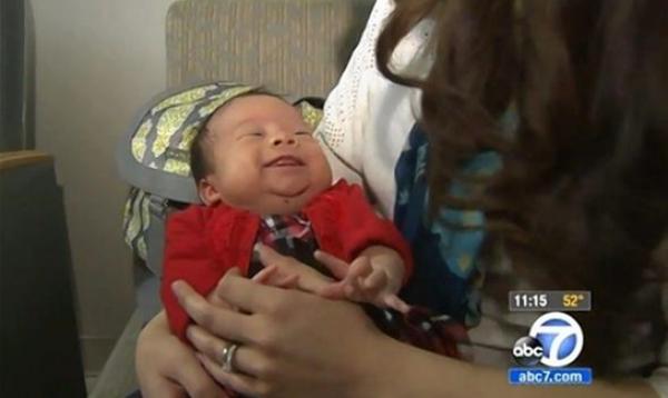 ولادة طفلة بلا دم يجري في عروقها