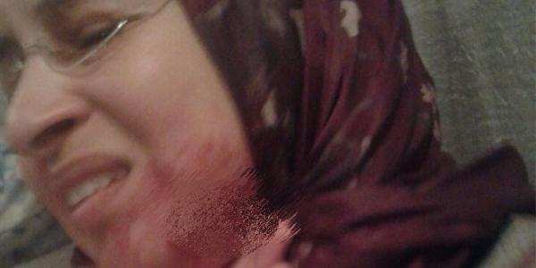 البيضاء .. لهذا السبب أقدم التلميذ على شرملة أستاذته بشفرة حلاقة