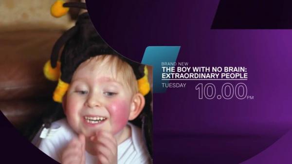 بالفيديو: طفل يتم عامه الرابع رغم ولادته دون دماغ