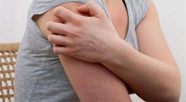 ما الملابس المناسبة لمرضى التهاب الجلد العصبي؟