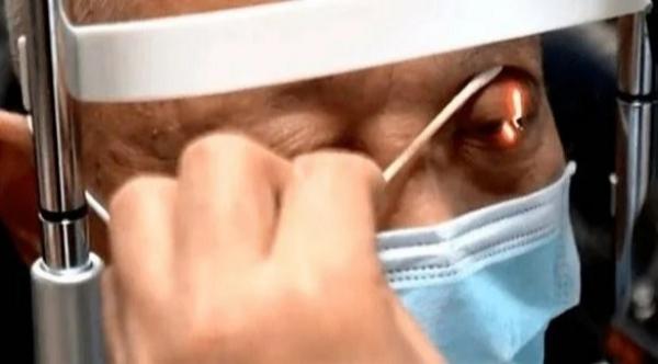 صيني يصاب بحالة نادرة تجعله يذرف الدموع كلما تناول الطعام