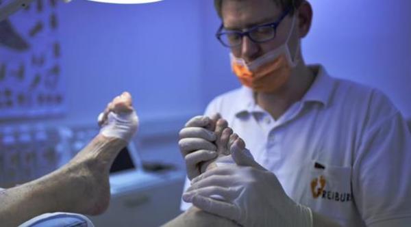 جروح القدم الصغيرة تهدد مرضى السكري بالبتر