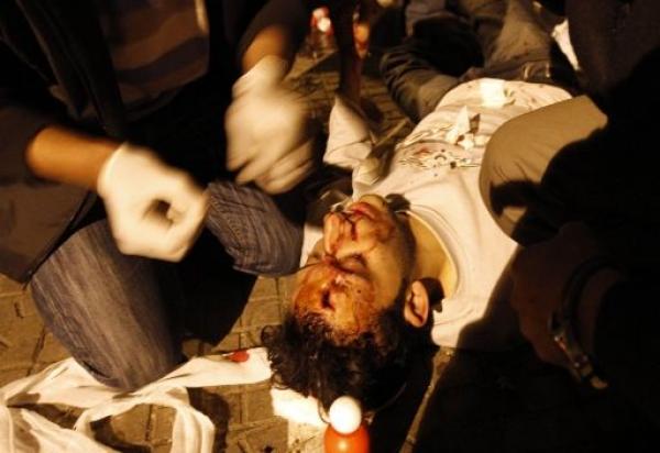 مصر.. أكثر من 100 مصاب في اشتباكات بميدان التحرير في جمعة "كشف الحساب"