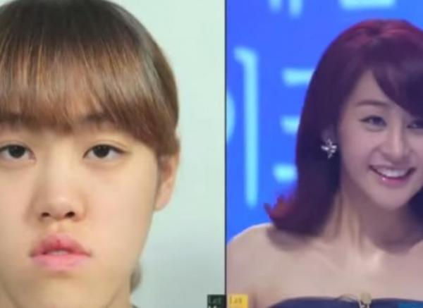 فيديو: كيف تحوّلت أبشع فتاة كوريّة إلى ملكة جمال؟