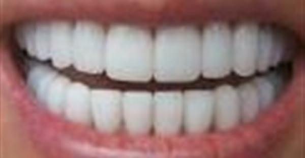 7 وصايا للحصول على أسنان صحية دون تسوس