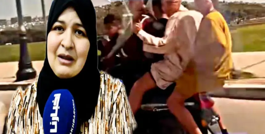 موطور سانيا يدمر حياة طفلها.. والأم تناشد بوقف الاستهتار بأرواح الصغار