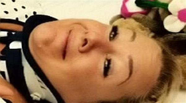 بريطانية تسقط أثناء سيرها نائمة وتصاب بالشلل